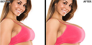 before after Safe Plastic Surgery?