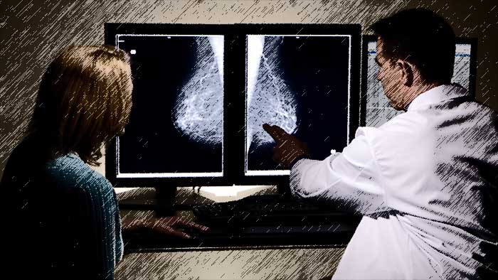 DIAGNOSIS: Breast Cancer