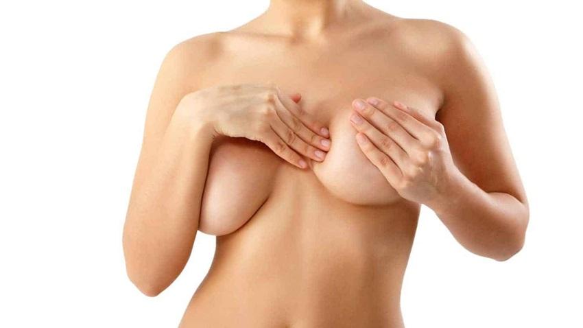 Breast Lift Aftermath